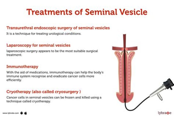 What is a seminal example?